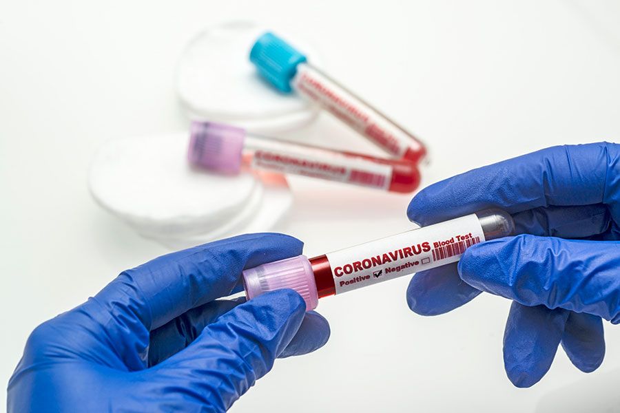 25.05 13:00 В Ульяновской области вдвое увеличилось количество проведенных в сутки тестов на коронавирусную инфекцию